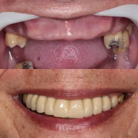 Resultado de tratamento odontológico 2